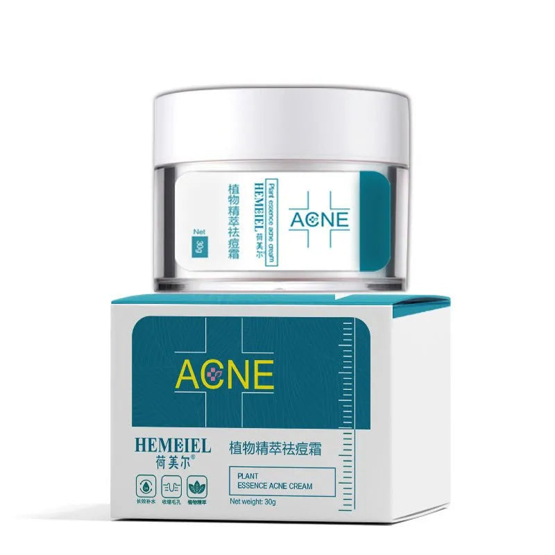 Acne Cream